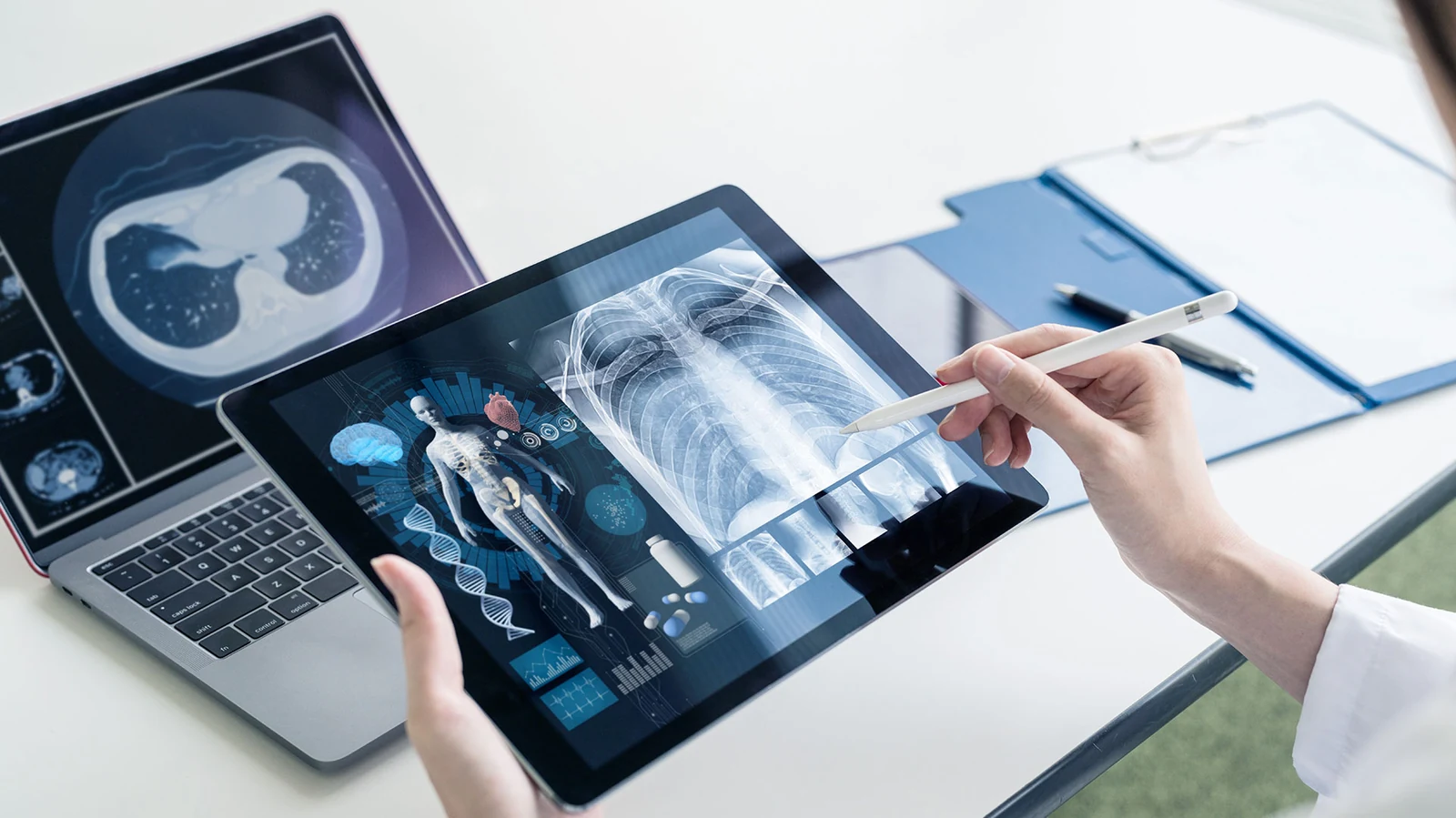 Doctor reviewing chest X-ray and diagnostic imaging on a tablet beside a laptop.